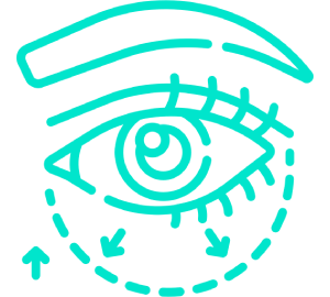Blepharoplasty